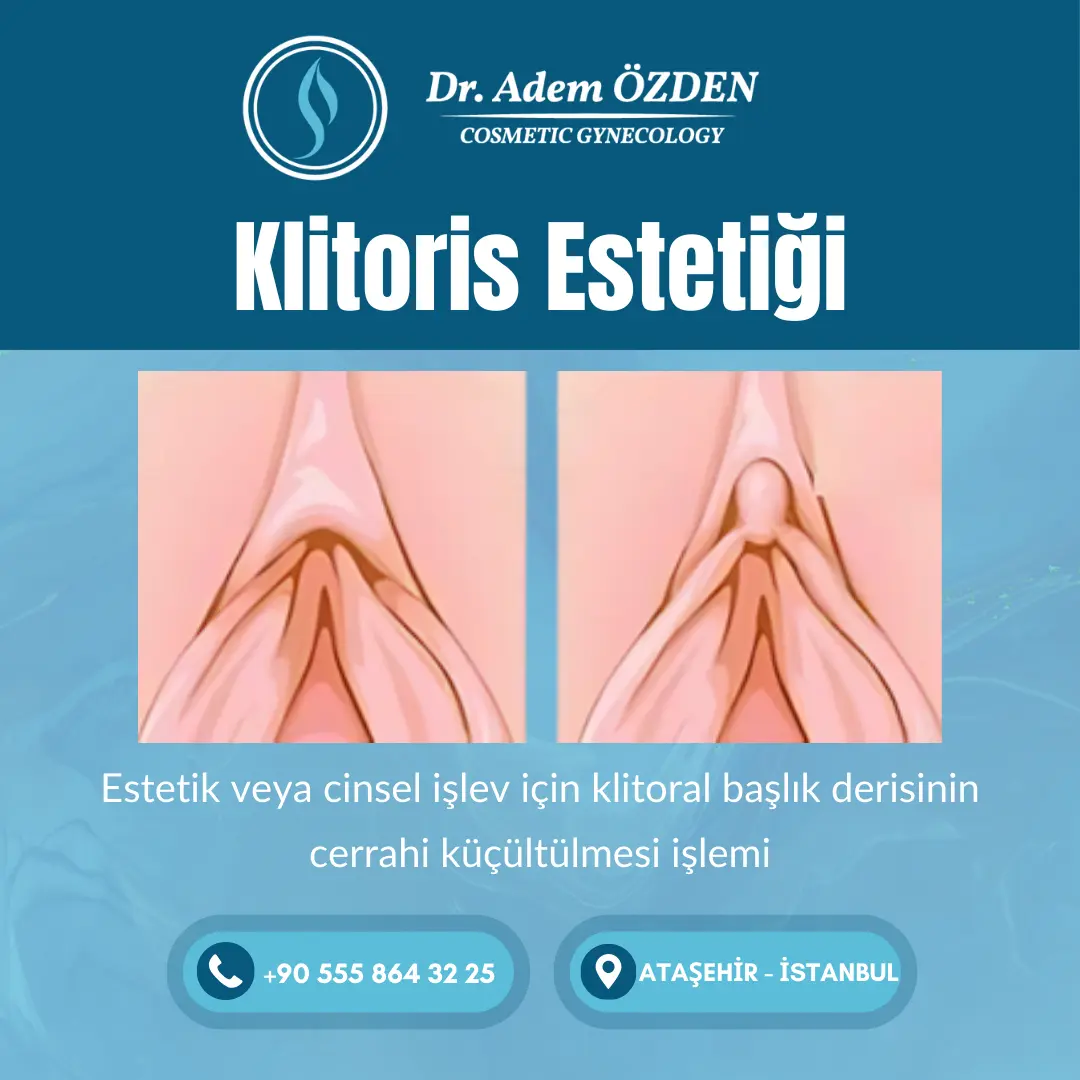 klitoris-estetigi-istanbul