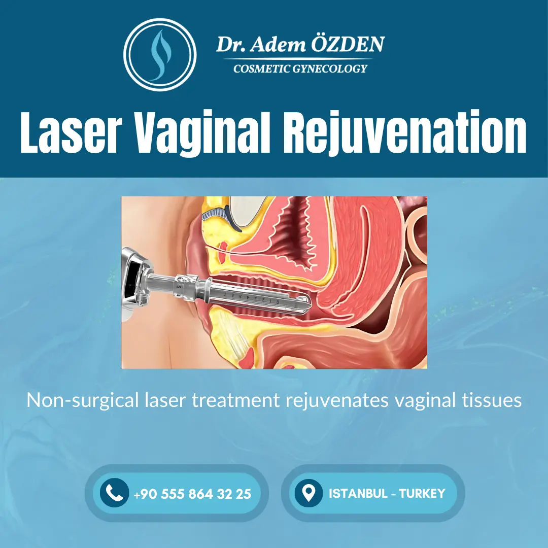 laser-vaginal-rejuvenation