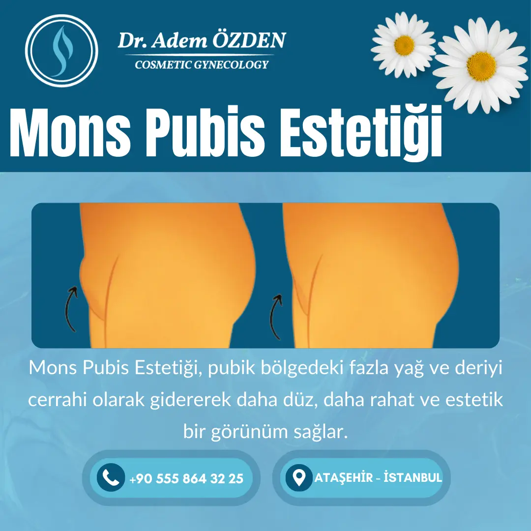 mons-pubis-estetigi