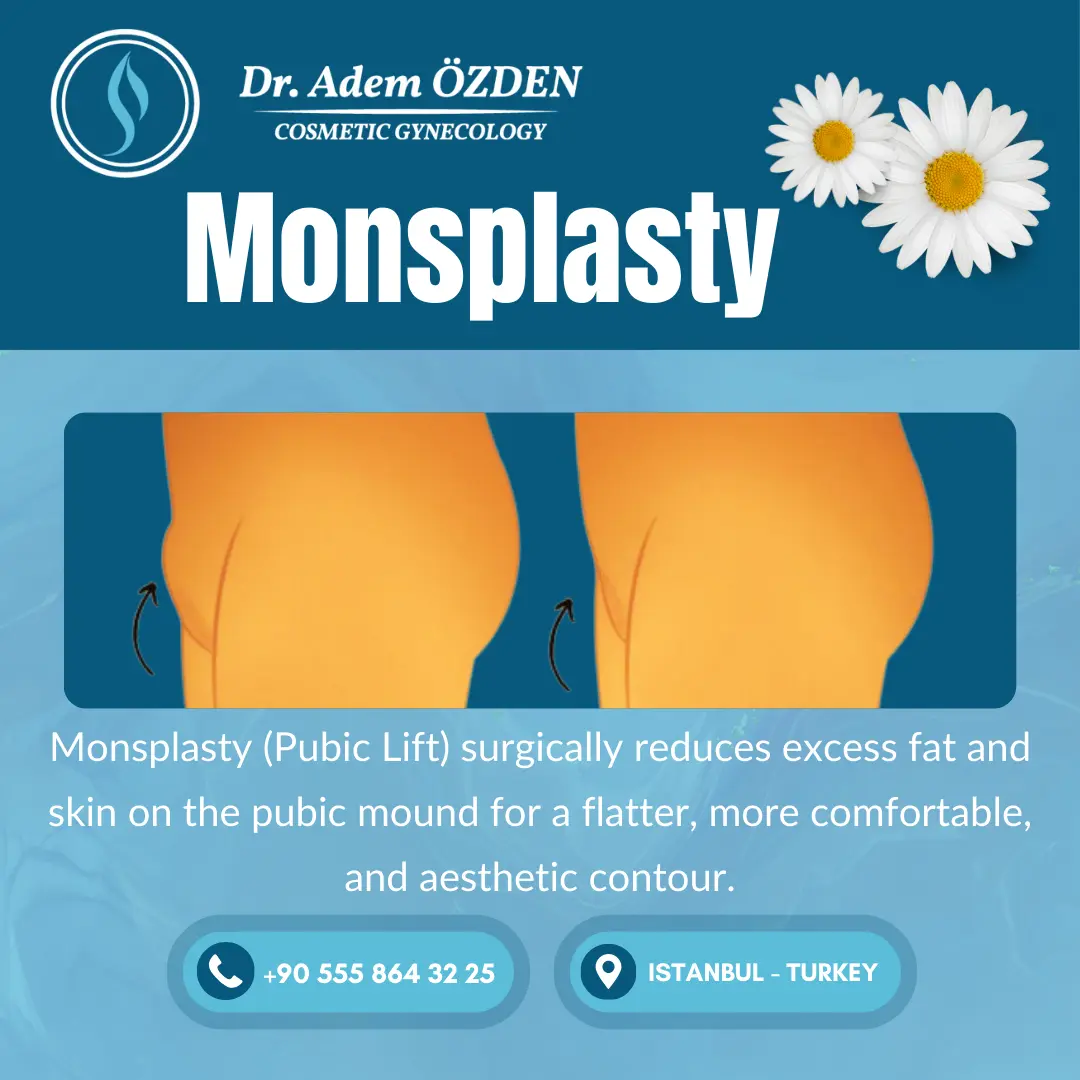 monsplasty-istanbul