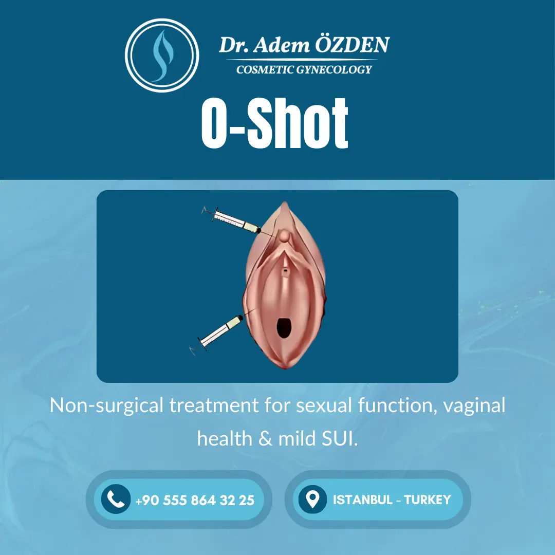 o-shot-istanbul