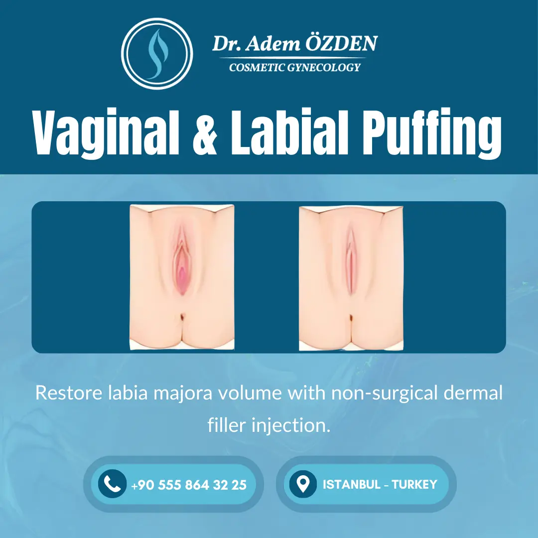 vaginal-puffing-istanbul