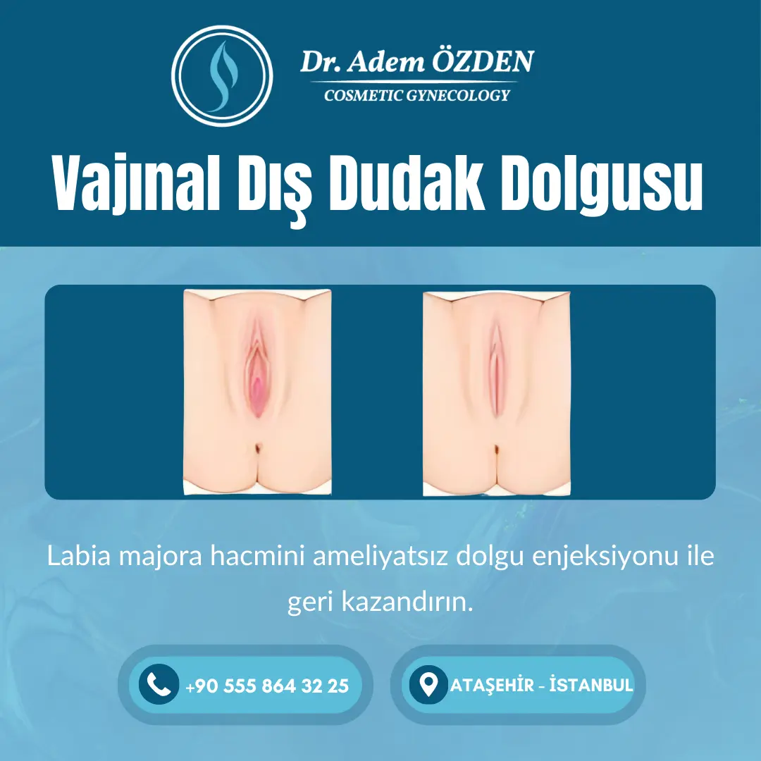 vajinal-dis-dudak-dolgusu