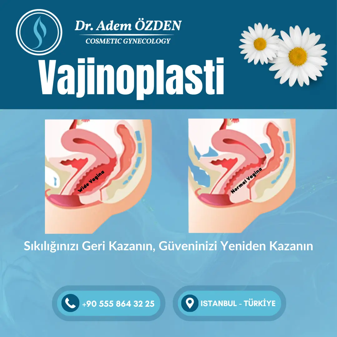 vajinoplasti-istanbul