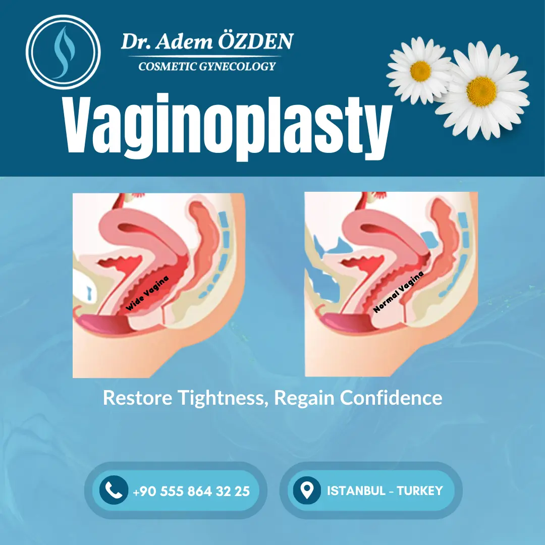 vaginoplasty-in-istanbul